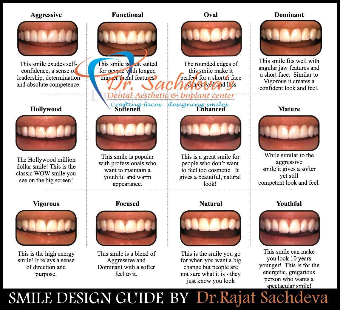 Digital smile Designing Treatment