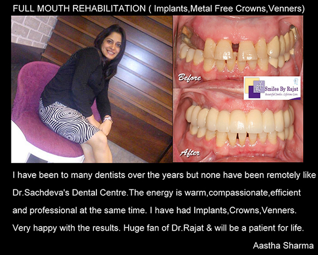 Dental Clinic in India, Dental Clinic Delhi, Patient Testimonial