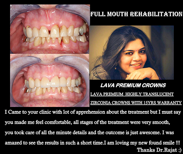 Dental Clinic in India, Dental Clinic Delhi, Patient Testimonial