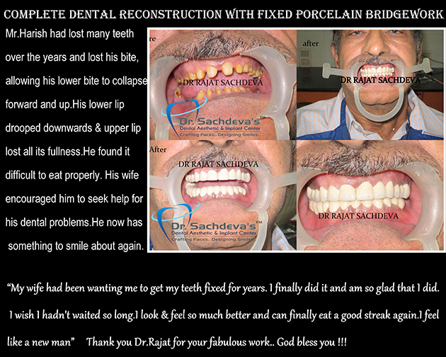 Dental Clinic in India, Dental Clinic Delhi, Patient Testimonial