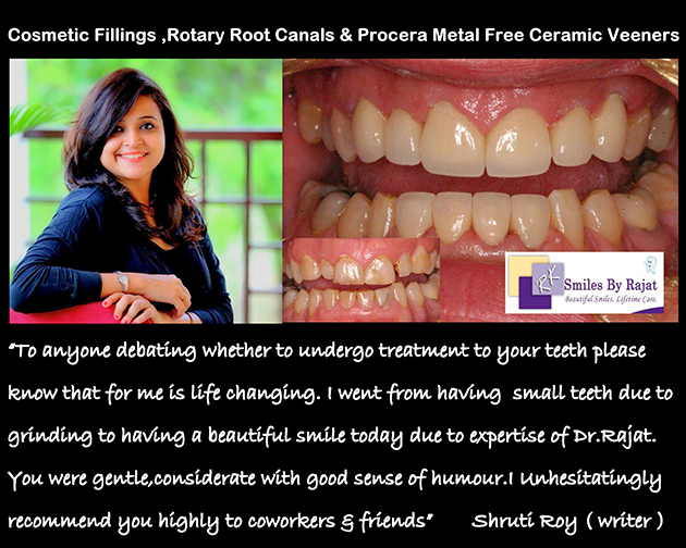 Dental Clinic in India, Dental Clinic Delhi, Patient Testimonial