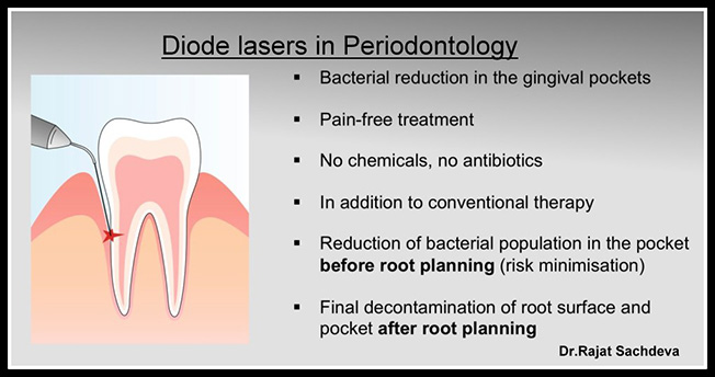 laser dentistry courses in delhi,Laser Dental Courses Delhi,Dentists Delhi,Dental Implants Clinic in Delhi