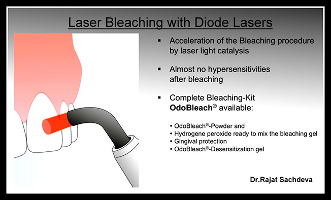 laser dentistry courses in delhi,Laser Dental Courses Delhi,Dentists Delhi,Dental Implants Clinic in Delhi