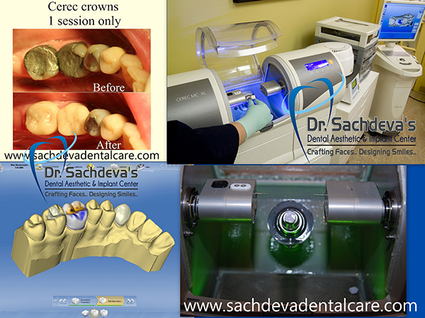 Dental Courses In Delhi,cosmetic dental surgery in delhi ,cosmetic dentist in delhi,Dental Implants Clinic in Delhi,cosmetic dentist delhi,dentist in delhi,dental implant courses in delhi,cost of tooth implant in delhi,tooth implant cost in delhi,cosmetic dentistry in delhi,dental clinic in delhi,laser dentistry courses in delhi,cosmetic dental surgery Delhi