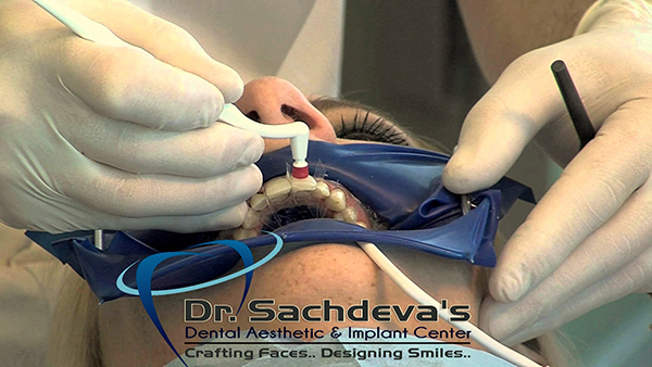 Dental Courses In Delhi,cosmetic dental surgery in delhi ,cosmetic dentist in delhi,Dental Implants Clinic in Delhi,cosmetic dentist delhi,dentist in delhi,dental implant courses in delhi,cost of tooth implant in delhi,tooth implant cost in delhi,cosmetic dentistry in delhi,dental clinic in delhi,laser dentistry courses in delhi,cosmetic dental surgery Delhi