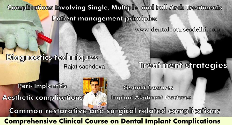 Implanto Dontia Course in India,Implanto Dontia Institute in Delhi