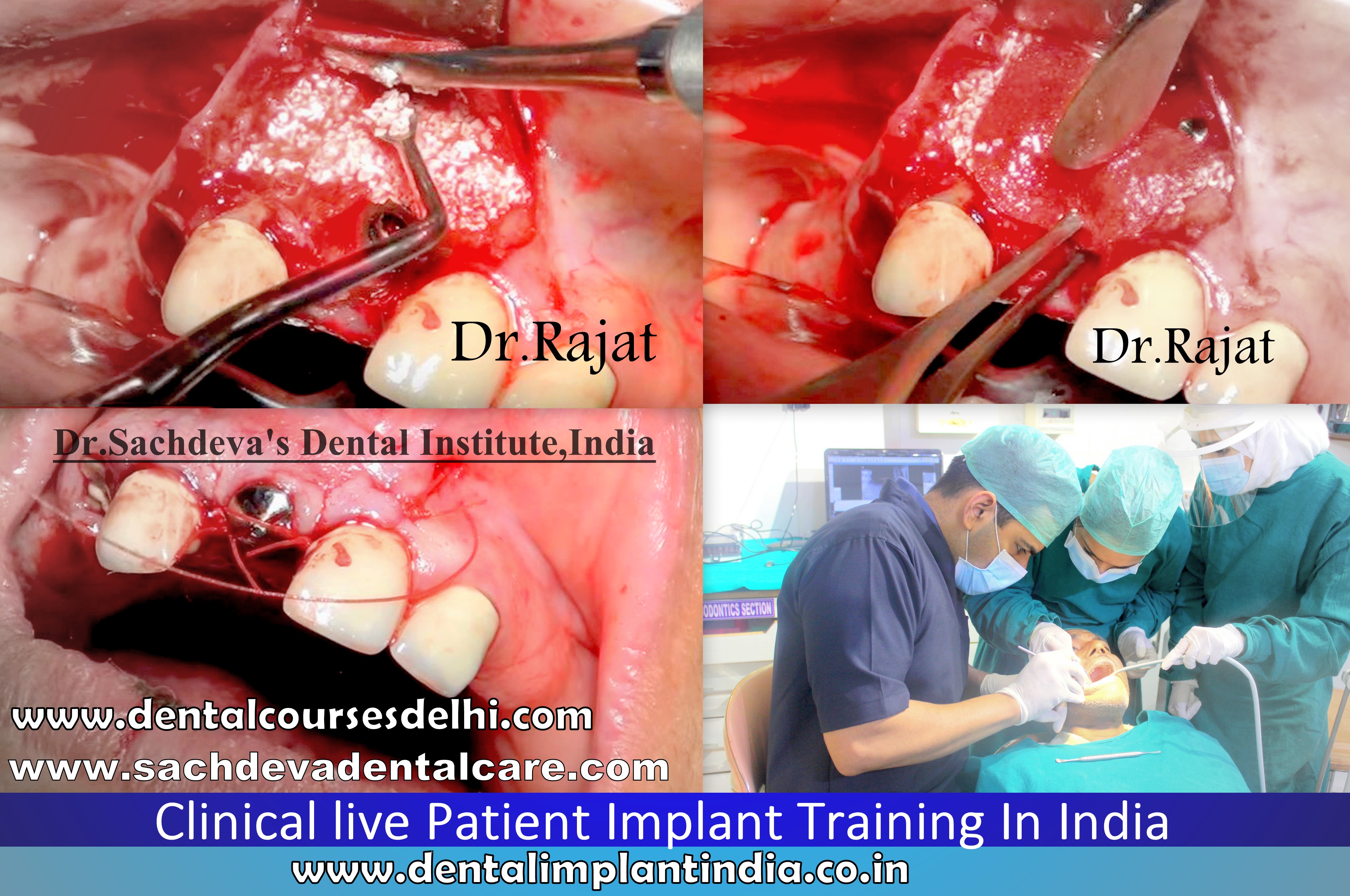 Implanto Dontia Course in India,Implanto Dontia Institute in Delhi