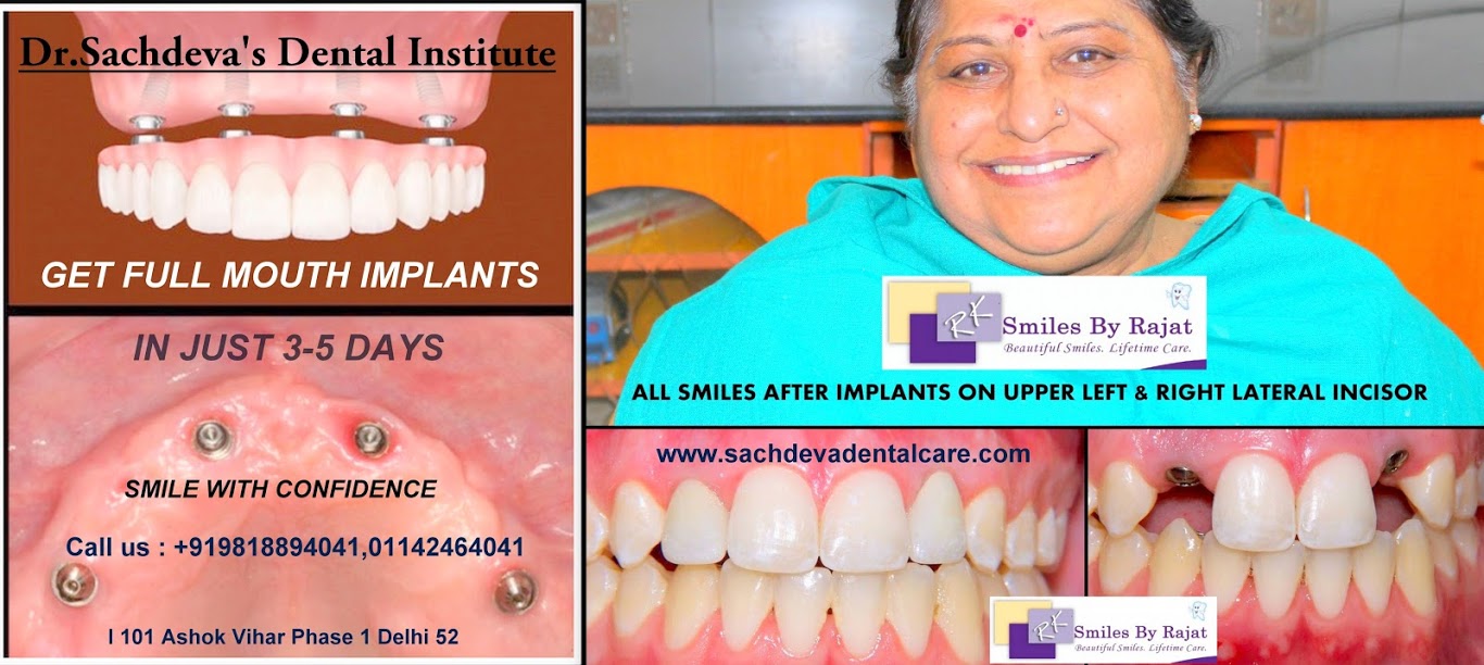 basal dental implant