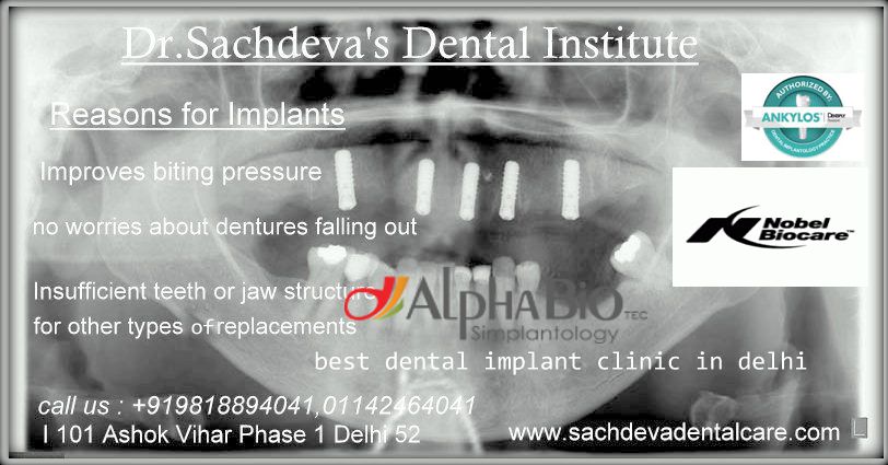 keyhole implant