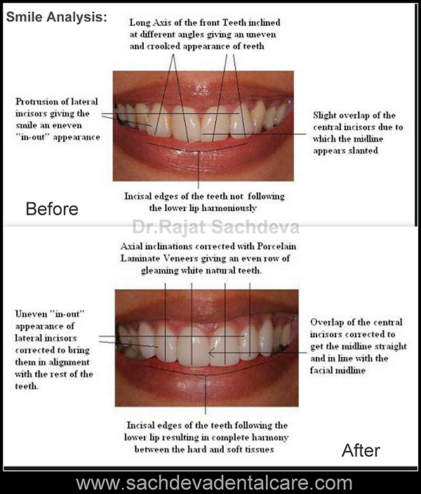 Smile analysis