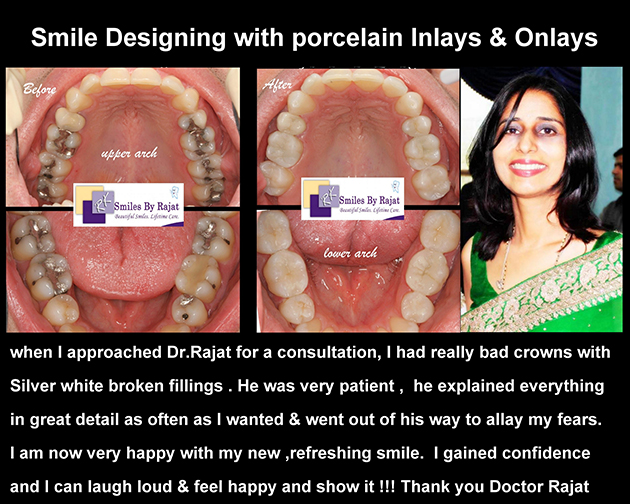 Dental Clinic in India, Dental Clinic Delhi, Patient Testimonial