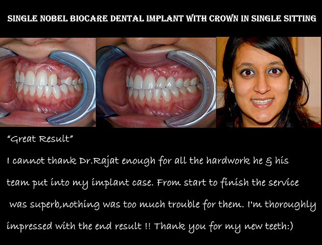 Dental Clinic in India, Dental Clinic Delhi, Patient Testimonial