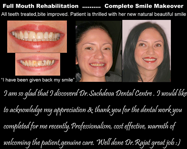 Dental Clinic in India, Dental Clinic Delhi, Patient Testimonial