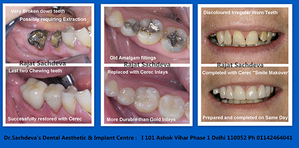 Dental Courses In Delhi,cosmetic dental surgery in delhi ,cosmetic dentist in delhi,Dental Implants Clinic in Delhi,cosmetic dentist delhi,dentist in delhi,dental implant courses in delhi,cost of tooth implant in delhi,tooth implant cost in delhi,cosmetic dentistry in delhi,dental clinic in delhi,laser dentistry courses in delhi,cosmetic dental surgery Delhi