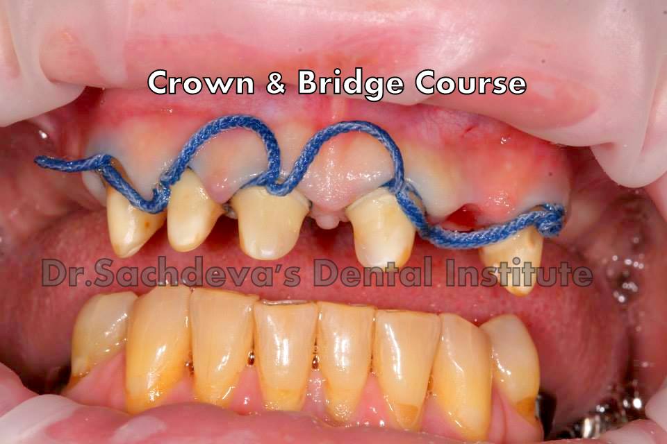 Dental Courses In Delhi,cosmetic dental surgery in delhi ,cosmetic dentist in delhi,Dental Implants Clinic in Delhi,cosmetic dentist delhi,dentist in delhi,dental implant courses in delhi,cost of tooth implant in delhi,tooth implant cost in delhi,cosmetic dentistry in delhi,dental clinic in delhi,laser dentistry courses in delhi,cosmetic dental surgery Delhi