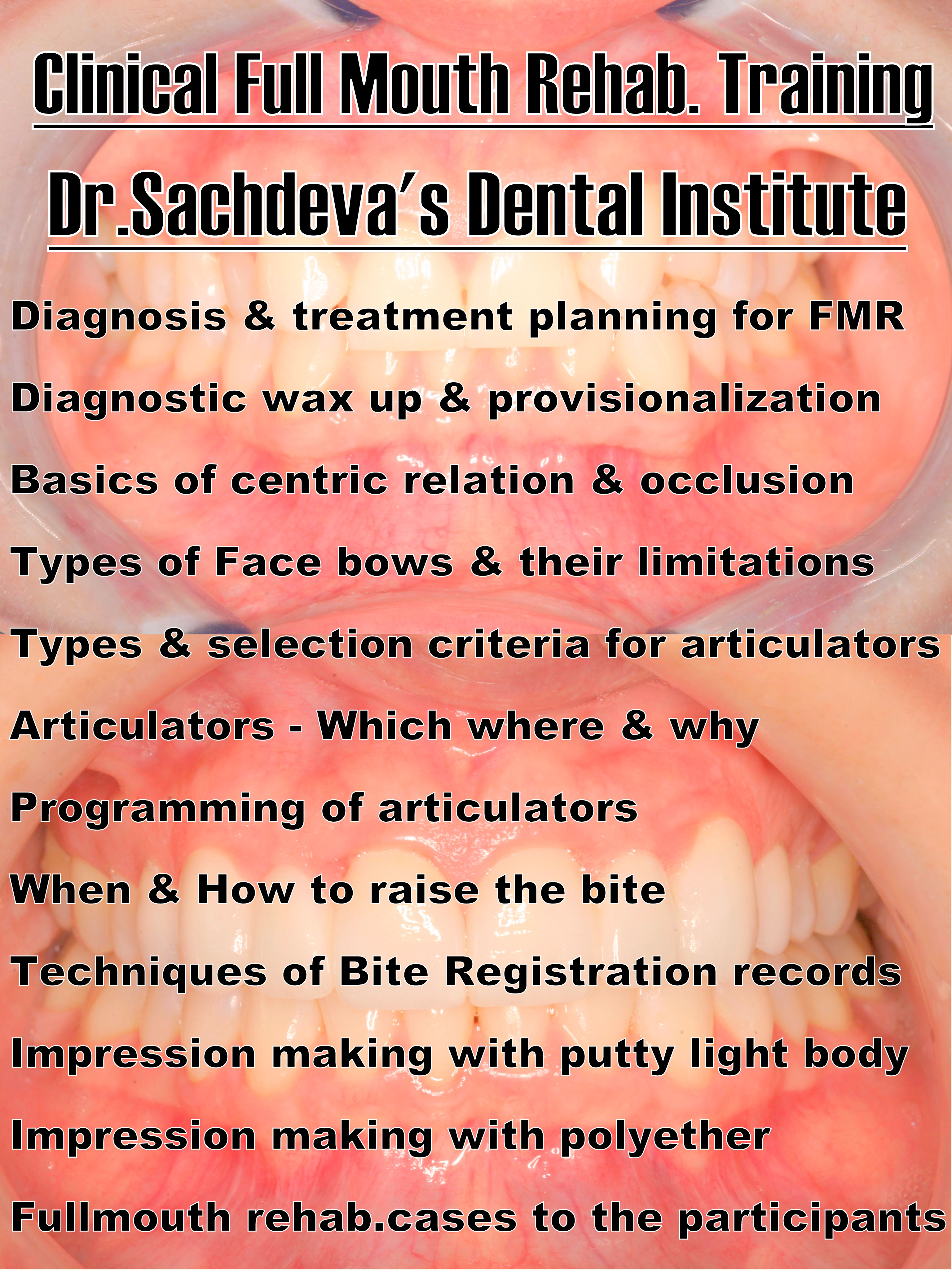 Dental Courses In Delhi,cosmetic dental surgery in delhi ,cosmetic dentist in delhi,Dental Implants Clinic in Delhi,cosmetic dentist delhi,dentist in delhi,dental implant courses in delhi,cost of tooth implant in delhi,tooth implant cost in delhi,cosmetic dentistry in delhi,dental clinic in delhi,laser dentistry courses in delhi,cosmetic dental surgery Delhi