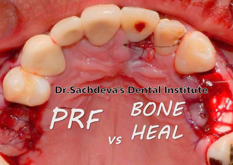 Periodontics