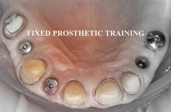 Dental Courses In Delhi,cosmetic dental surgery in delhi ,cosmetic dentist in delhi,Dental Implants Clinic in Delhi,cosmetic dentist delhi,dentist in delhi,dental implant courses in delhi,cost of tooth implant in delhi,tooth implant cost in delhi,cosmetic dentistry in delhi,dental clinic in delhi,laser dentistry courses in delhi,cosmetic dental surgery Delhi