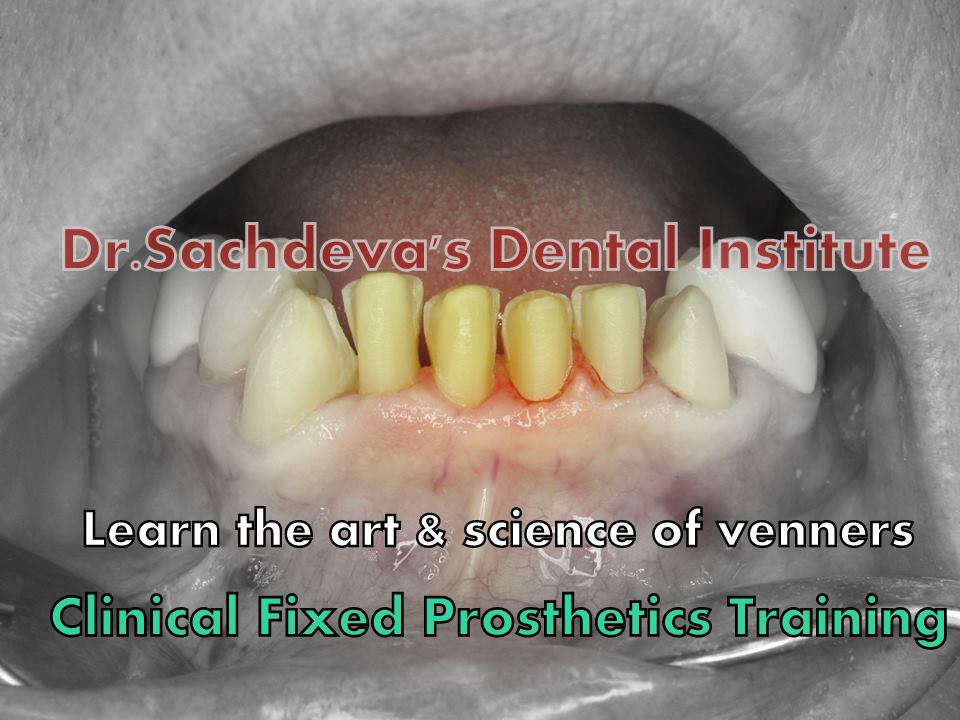 Dental Courses In Delhi,cosmetic dental surgery in delhi ,cosmetic dentist in delhi,Dental Implants Clinic in Delhi,cosmetic dentist delhi,dentist in delhi,dental implant courses in delhi,cost of tooth implant in delhi,tooth implant cost in delhi,cosmetic dentistry in delhi,dental clinic in delhi,laser dentistry courses in delhi,cosmetic dental surgery Delhi