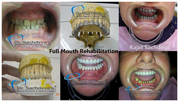 Dental Courses In Delhi,cosmetic dental surgery in delhi ,cosmetic dentist in delhi,Dental Implants Clinic in Delhi,cosmetic dentist delhi,dentist in delhi,dental implant courses in delhi,cost of tooth implant in delhi,tooth implant cost in delhi,cosmetic dentistry in delhi,dental clinic in delhi,laser dentistry courses in delhi,cosmetic dental surgery Delhi