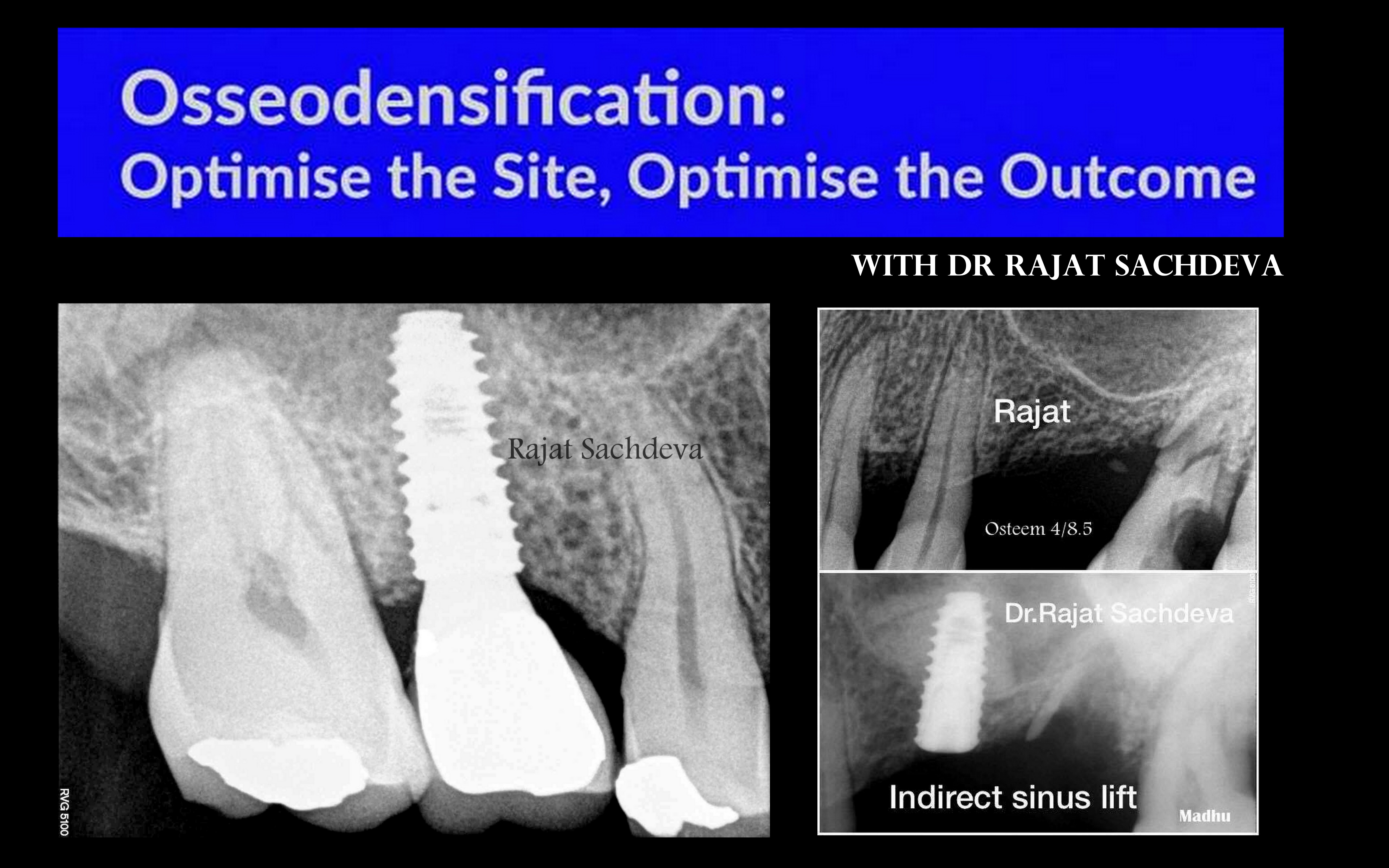 Dental Courses In Delhi,cosmetic dental surgery in delhi ,cosmetic dentist in delhi,Dental Implants Clinic in Delhi,cosmetic dentist delhi,dentist in delhi,dental implant courses in delhi,cost of tooth implant in delhi,tooth implant cost in delhi,cosmetic dentistry in delhi,dental clinic in delhi,laser dentistry courses in delhi,cosmetic dental surgery Delhi