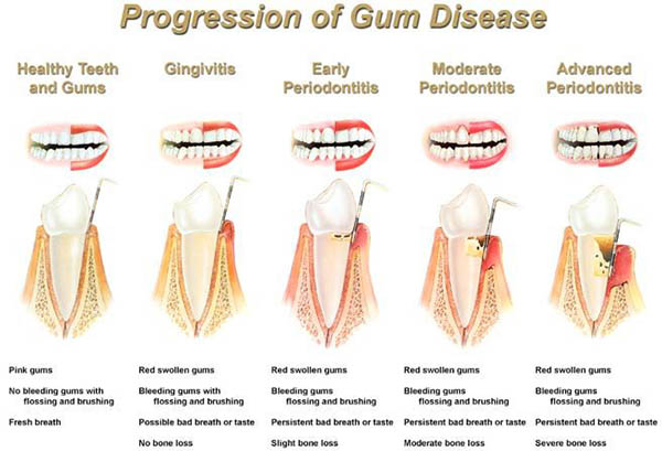 Dental Courses In Delhi,cosmetic dental surgery in delhi ,cosmetic dentist in delhi,Dental Implants Clinic in Delhi,cosmetic dentist delhi,dentist in delhi,dental implant courses in delhi,cost of tooth implant in delhi,tooth implant cost in delhi,cosmetic dentistry in delhi,dental clinic in delhi,laser dentistry courses in delhi,cosmetic dental surgery Delhi