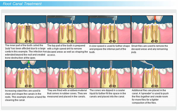 Dental Courses In Delhi,cosmetic dental surgery in delhi ,cosmetic dentist in delhi,Dental Implants Clinic in Delhi,cosmetic dentist delhi,dentist in delhi,dental implant courses in delhi,cost of tooth implant in delhi,tooth implant cost in delhi,cosmetic dentistry in delhi,dental clinic in delhi,laser dentistry courses in delhi,cosmetic dental surgery Delhi