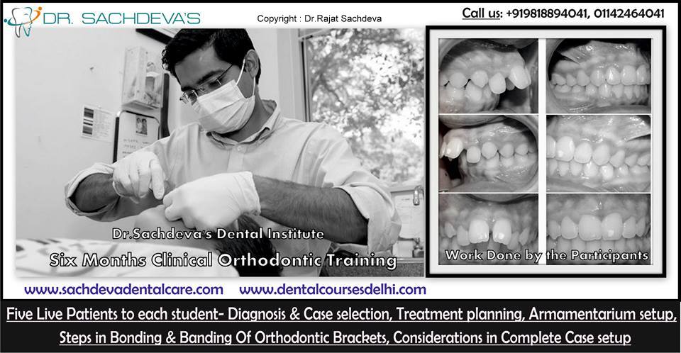 Dental Courses In Delhi,cosmetic dental surgery in delhi ,cosmetic dentist in delhi,Dental Implants Clinic in Delhi,cosmetic dentist delhi,dentist in delhi,dental implant courses in delhi,cost of tooth implant in delhi,tooth implant cost in delhi,cosmetic dentistry in delhi,dental clinic in delhi,laser dentistry courses in delhi,cosmetic dental surgery Delhi